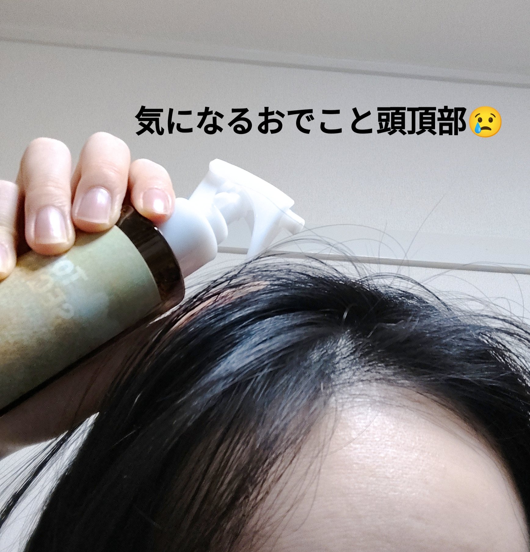 頭皮ローション トップシークレット/Makemerry/頭皮ローションを使ったクチコミ（2枚目）