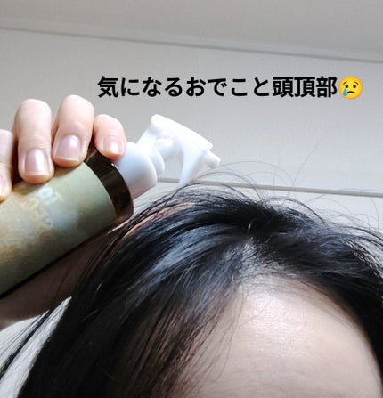 頭皮ローション トップシークレット/Makemerry/頭皮ローションを使ったクチコミ(2枚目)