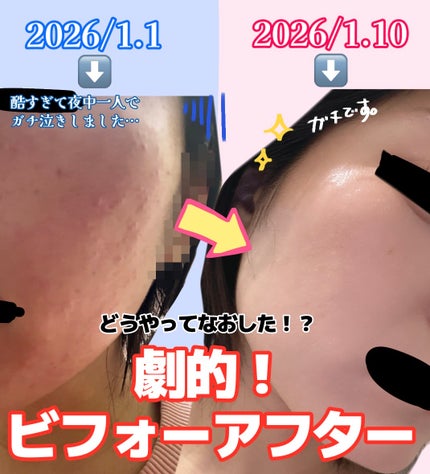 潤浸保湿 モイストリペアシートマスク 4枚入/キュレル/シートマスク・パックの画像