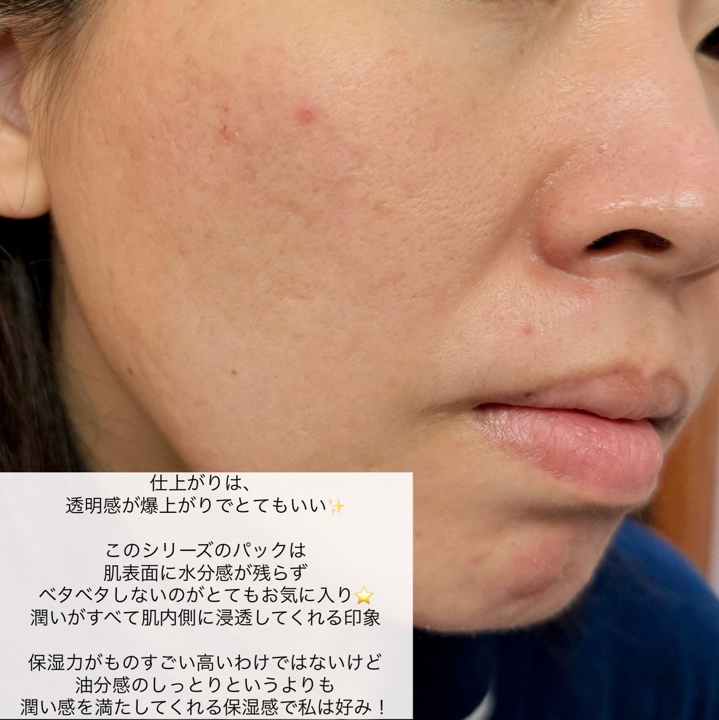 TXAナイアシンアミド ブライトニングマスク/from medi+/シートマスク・パックを使ったクチコミ(5枚目)