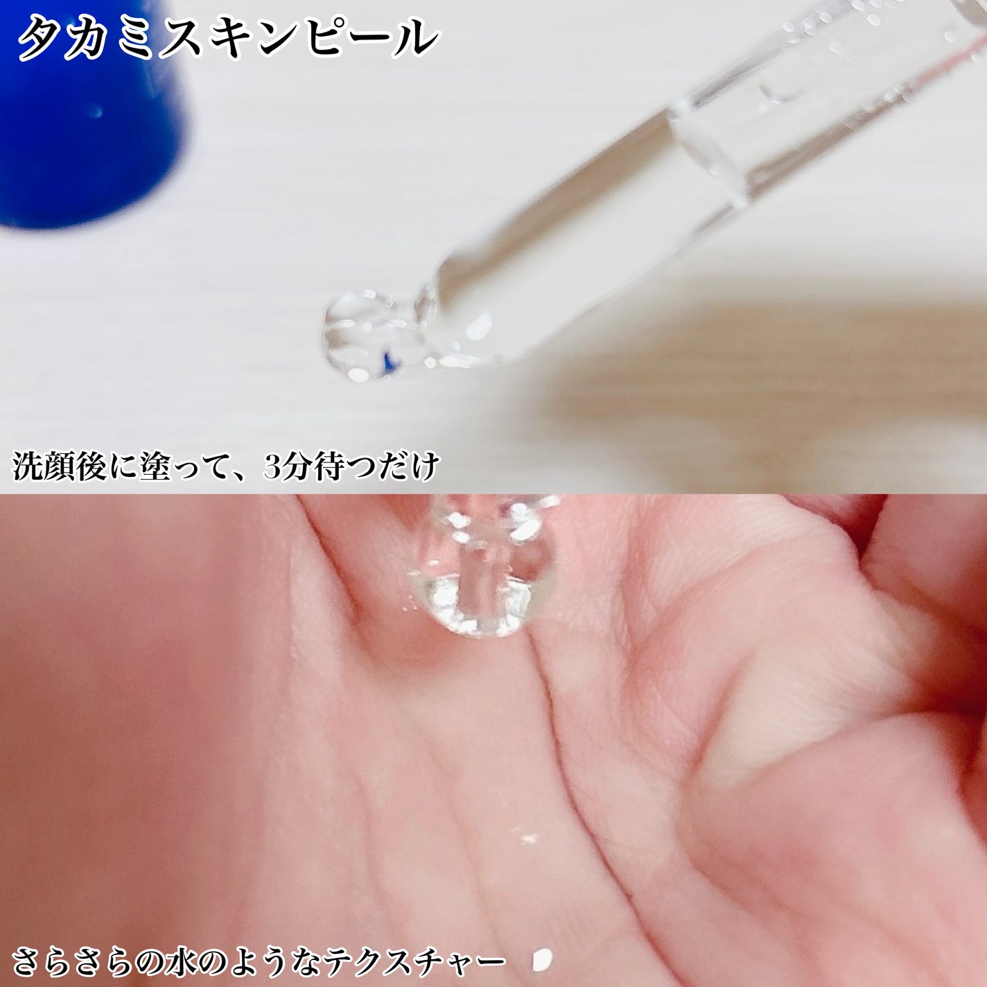 タカミスキンピール/タカミ/ブースター・導入液を使ったクチコミ(3枚目)