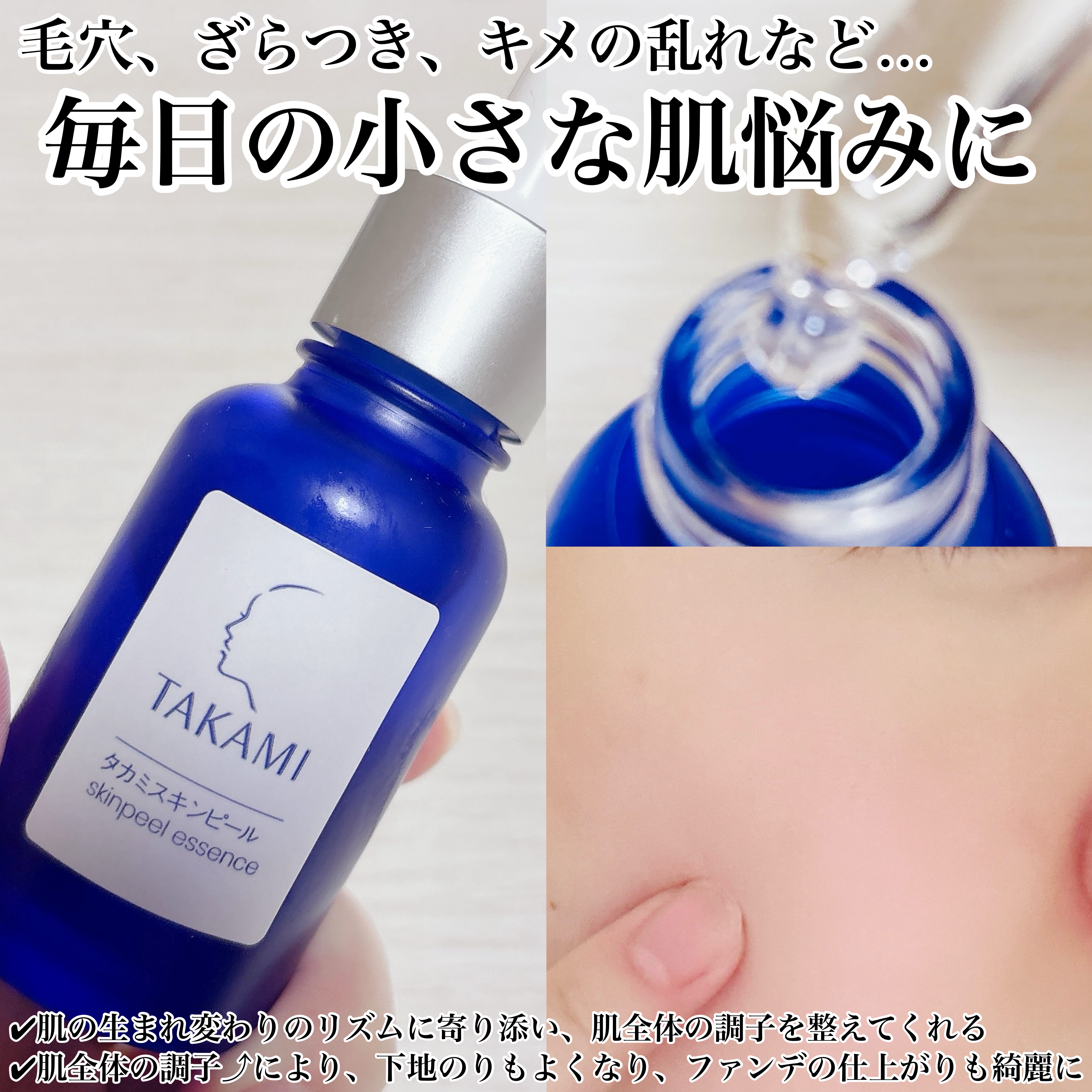 タカミスキンピール/タカミ/ブースター・導入液を使ったクチコミ（2枚目）