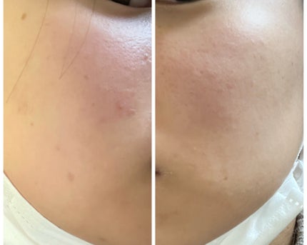 ぽむ on LIPS 「1枚目 2026.1.6エピデュオ 846日目2枚目 2026..」(4枚目)