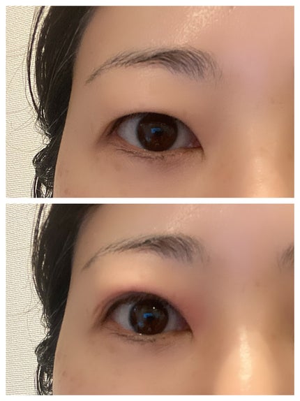 Eye kutto/メザイク/二重まぶた用アイテムを使ったクチコミ(5枚目)