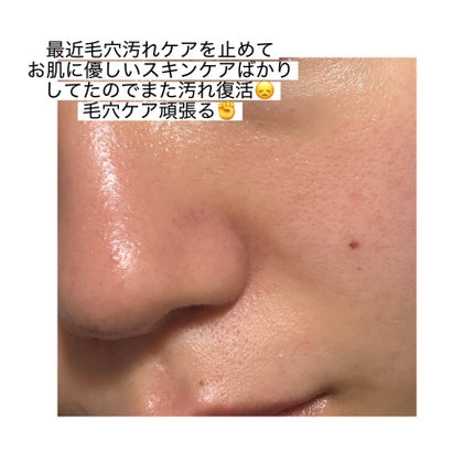 セラムヴェール ローション/ONE BY KOSE/化粧水を使ったクチコミ(2枚目)