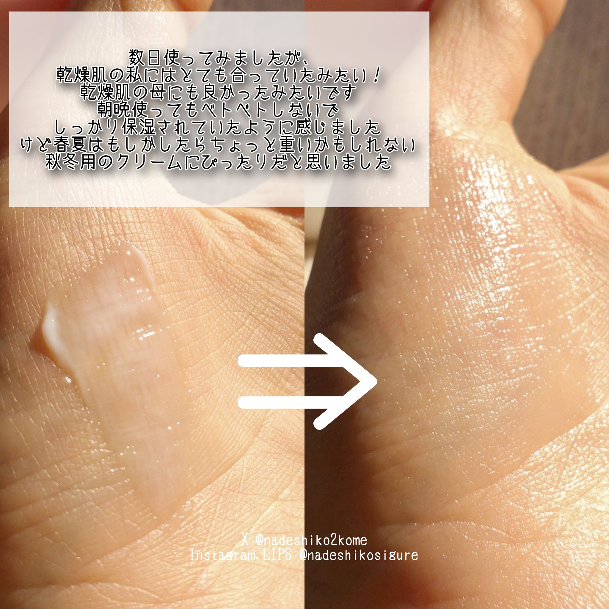 乾燥さん 乾燥さん　薬用高保湿クリームのクチコミ「🩷️乾燥さん　薬用高保湿クリーム

#コスメ購入品 です

数日使ってみましたが、乾燥肌の私に.....」（3枚目）