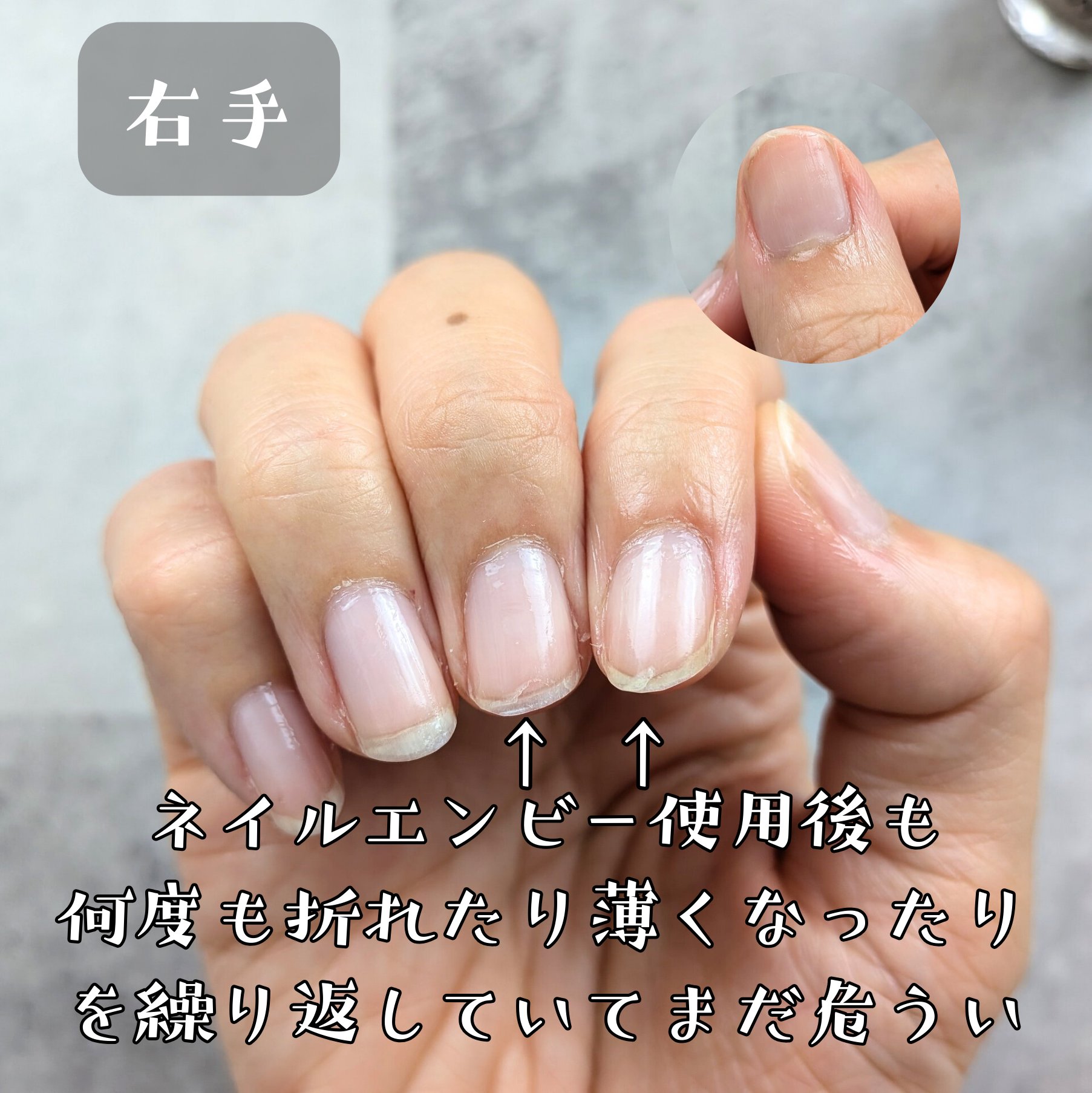 ネイルエンビー/O・P・I/ネイルオイル・トリートメントを使ったクチコミ（3枚目）