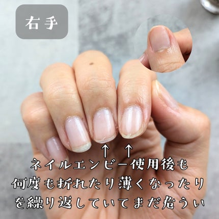 ネイルエンビー/O・P・I/ネイルオイル・トリートメントを使ったクチコミ(3枚目)