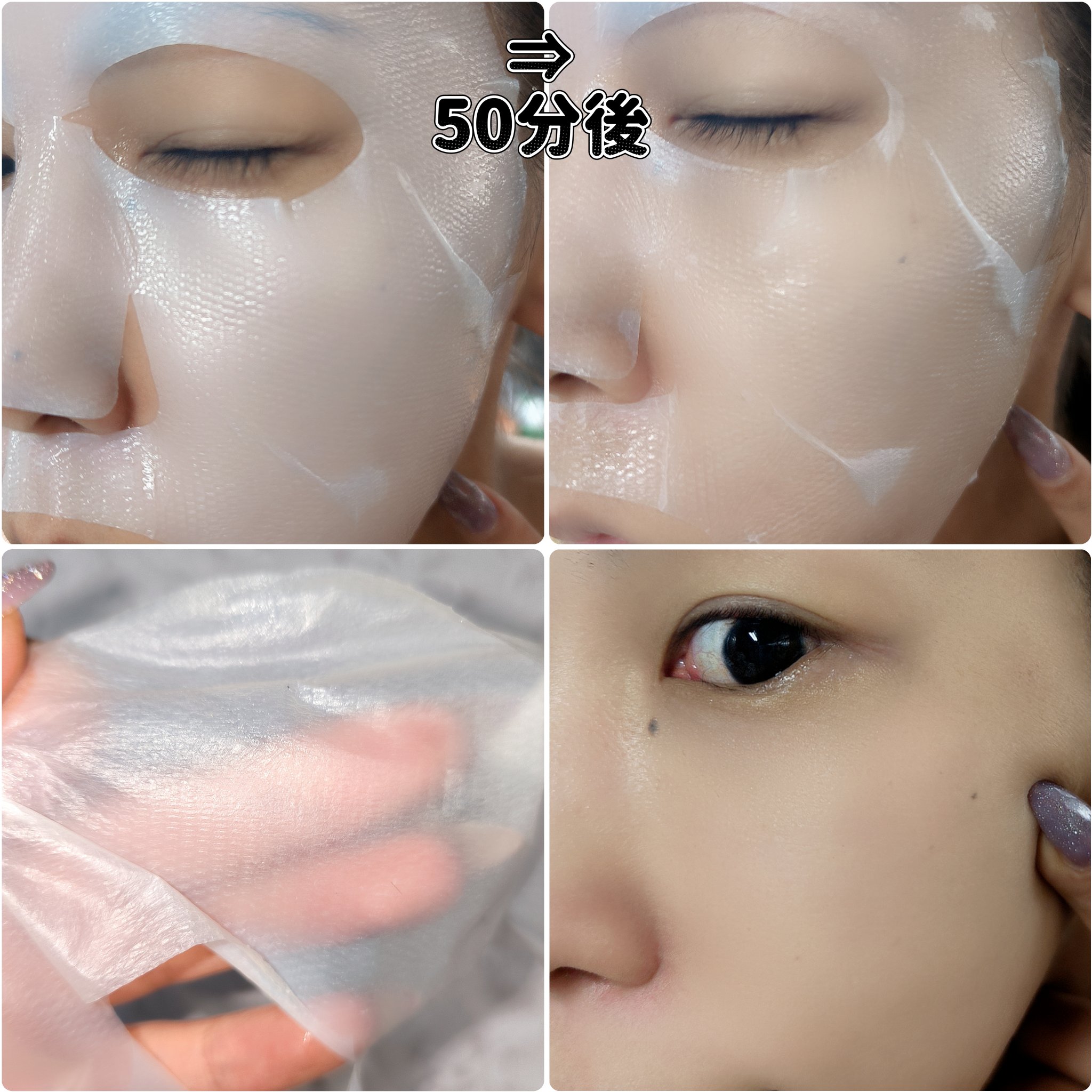 トラブルパッチマスク/EIOM/その他スキンケアを使ったクチコミ（3枚目）