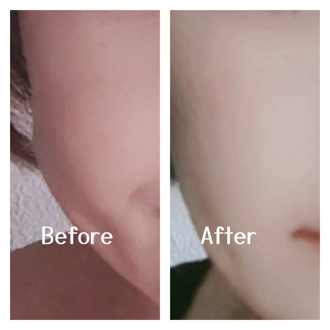 C×AZ ダーマインショット200/ESIENCE/美容液を使ったクチコミ（3枚目）