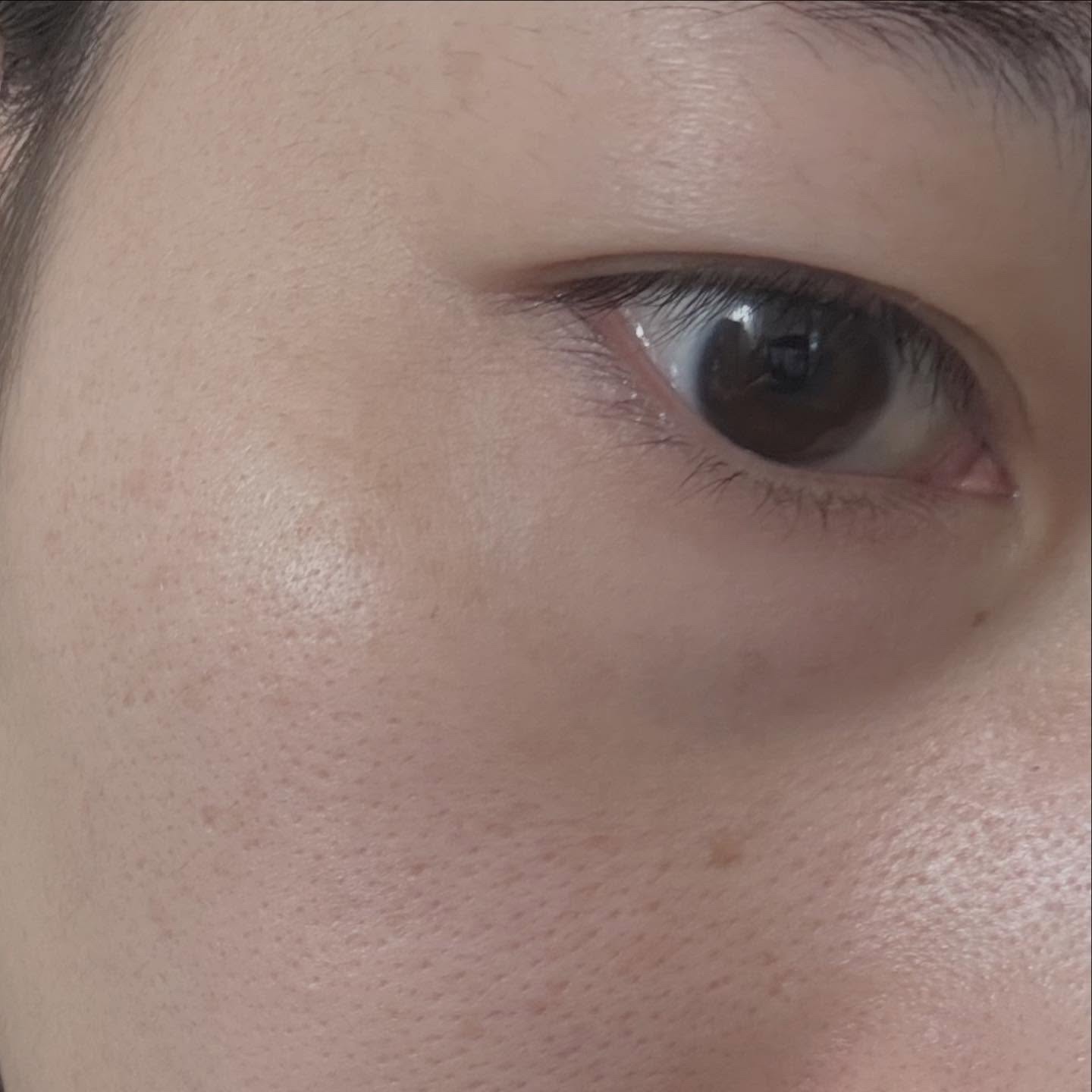 C×AZ ダーマインショット200/ESIENCE/美容液を使ったクチコミ（2枚目）