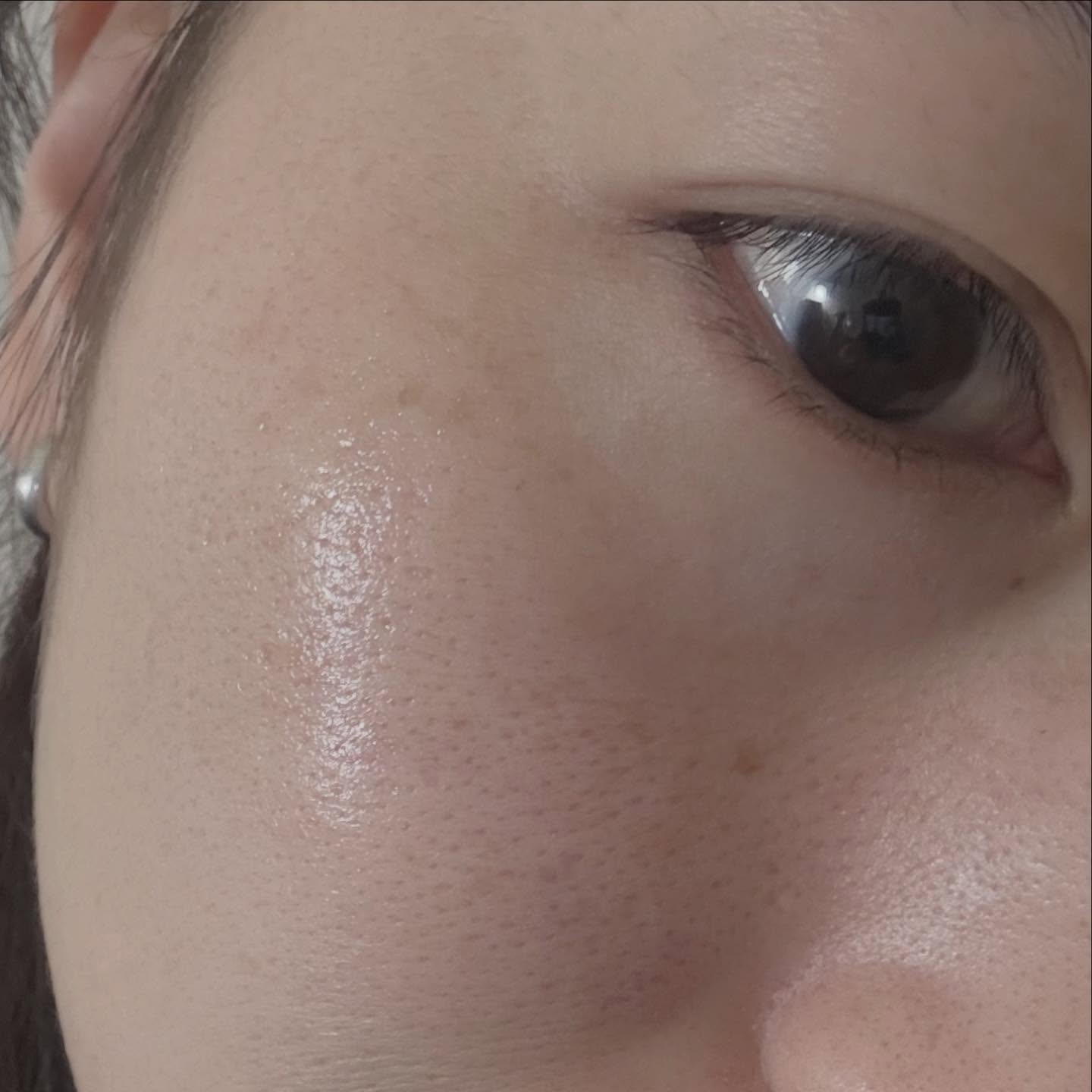 C×AZ ダーマインショット200/ESIENCE/美容液を使ったクチコミ（3枚目）