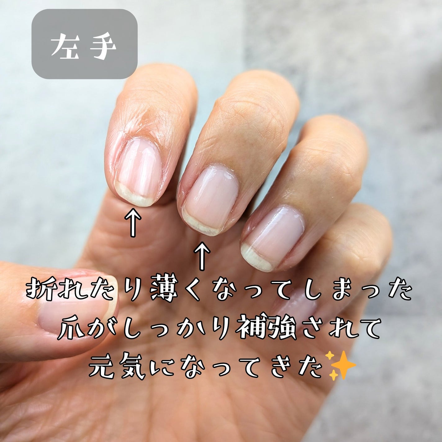 ネイルエンビー/O・P・I/ネイルオイル・トリートメントを使ったクチコミ(2枚目)