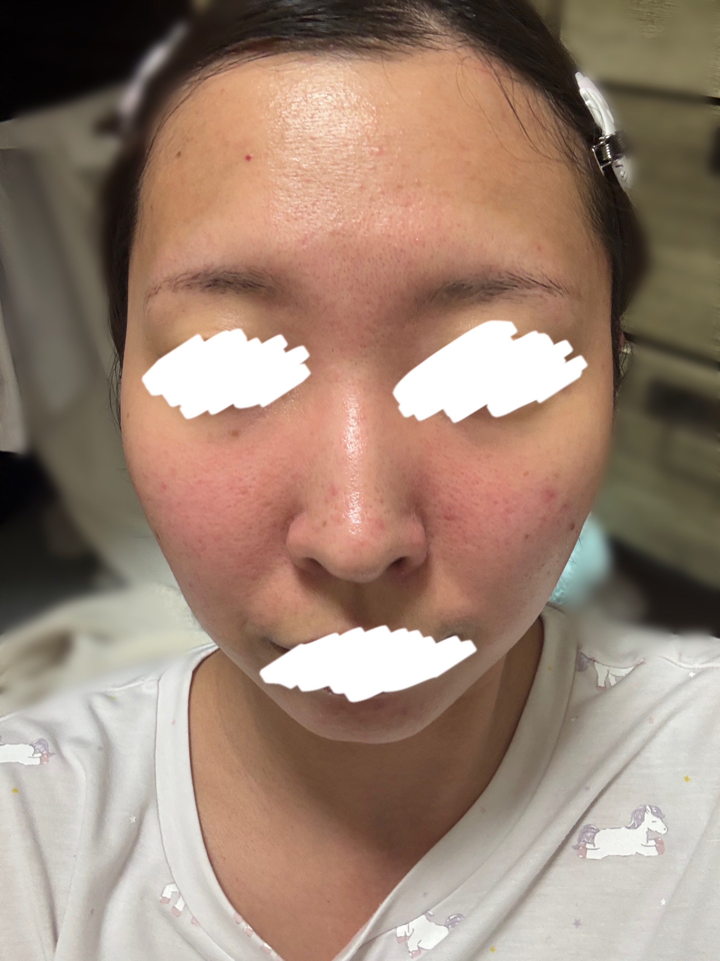 極潤プレミアム ヒアルロン乳液/肌ラボ/乳液を使ったクチコミ（2枚目）