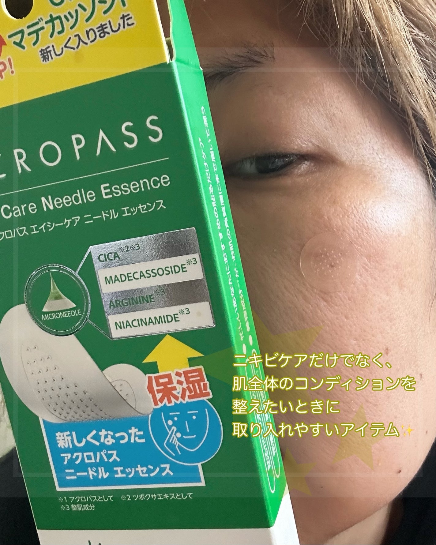 エイシーケアNE/ACROPASS/その他スキンケアを使ったクチコミ(4枚目)