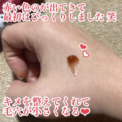 ミニレッドリードルS/VT/美容液を使ったクチコミ(2枚目)