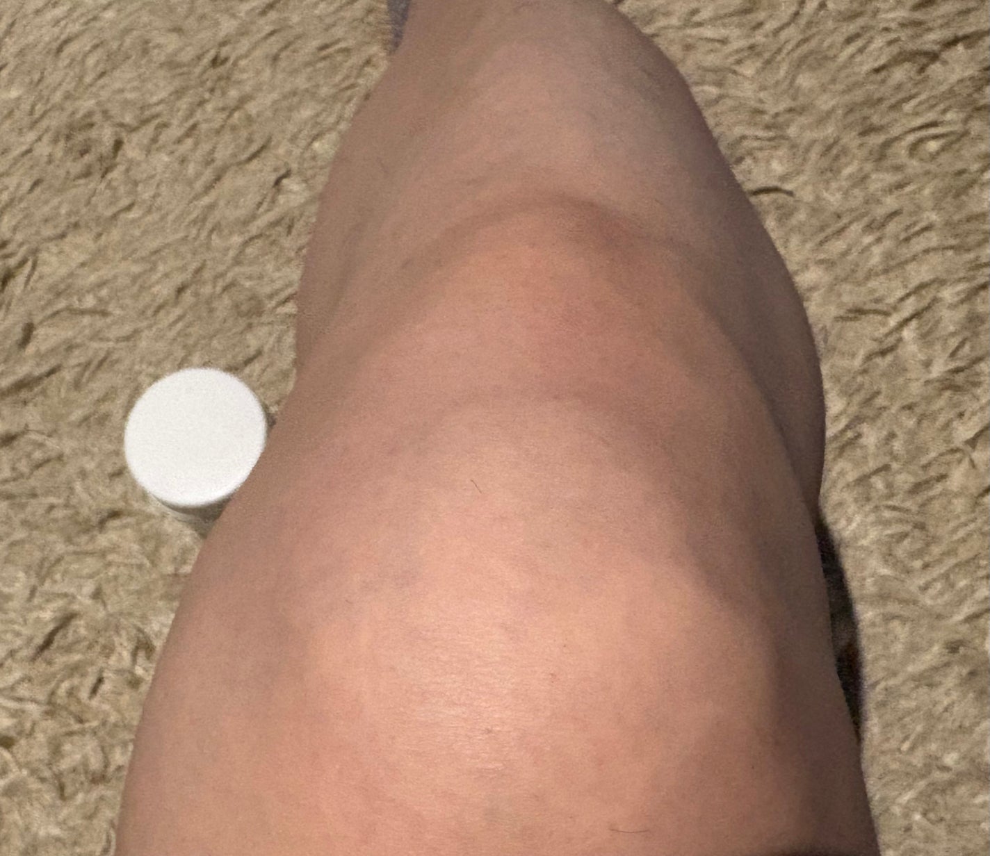 U20クリーム(医薬品)/メンターム/その他を使ったクチコミ(5枚目)