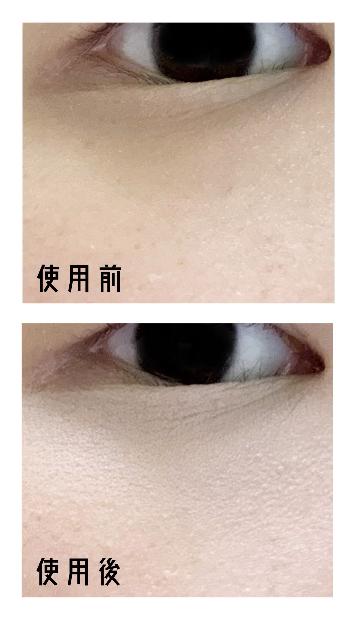 クマメンテパウダー/muice/パウダーコンシーラーを使ったクチコミ（2枚目）