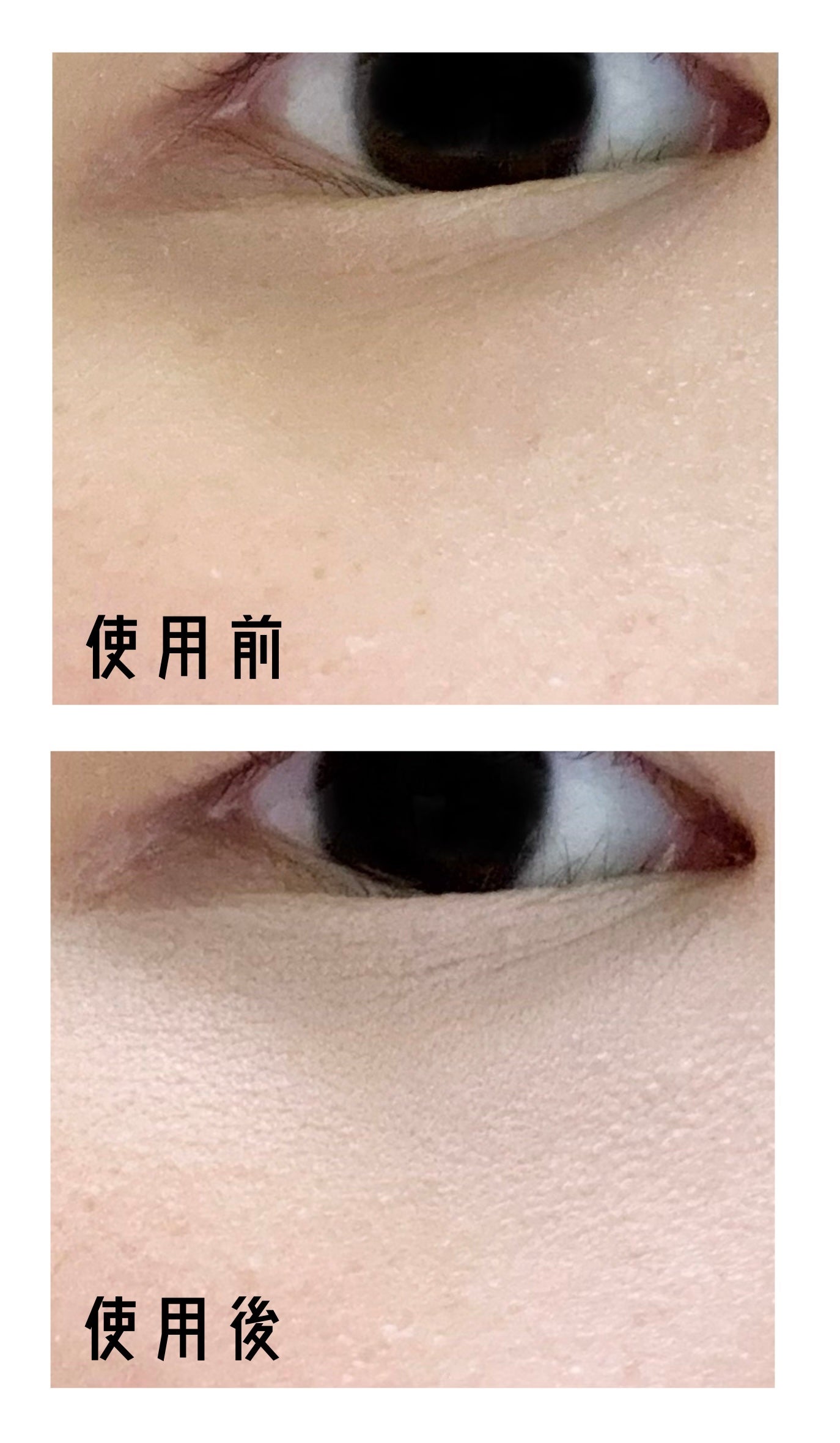 クマメンテパウダー/muice/パウダーコンシーラーを使ったクチコミ(2枚目)