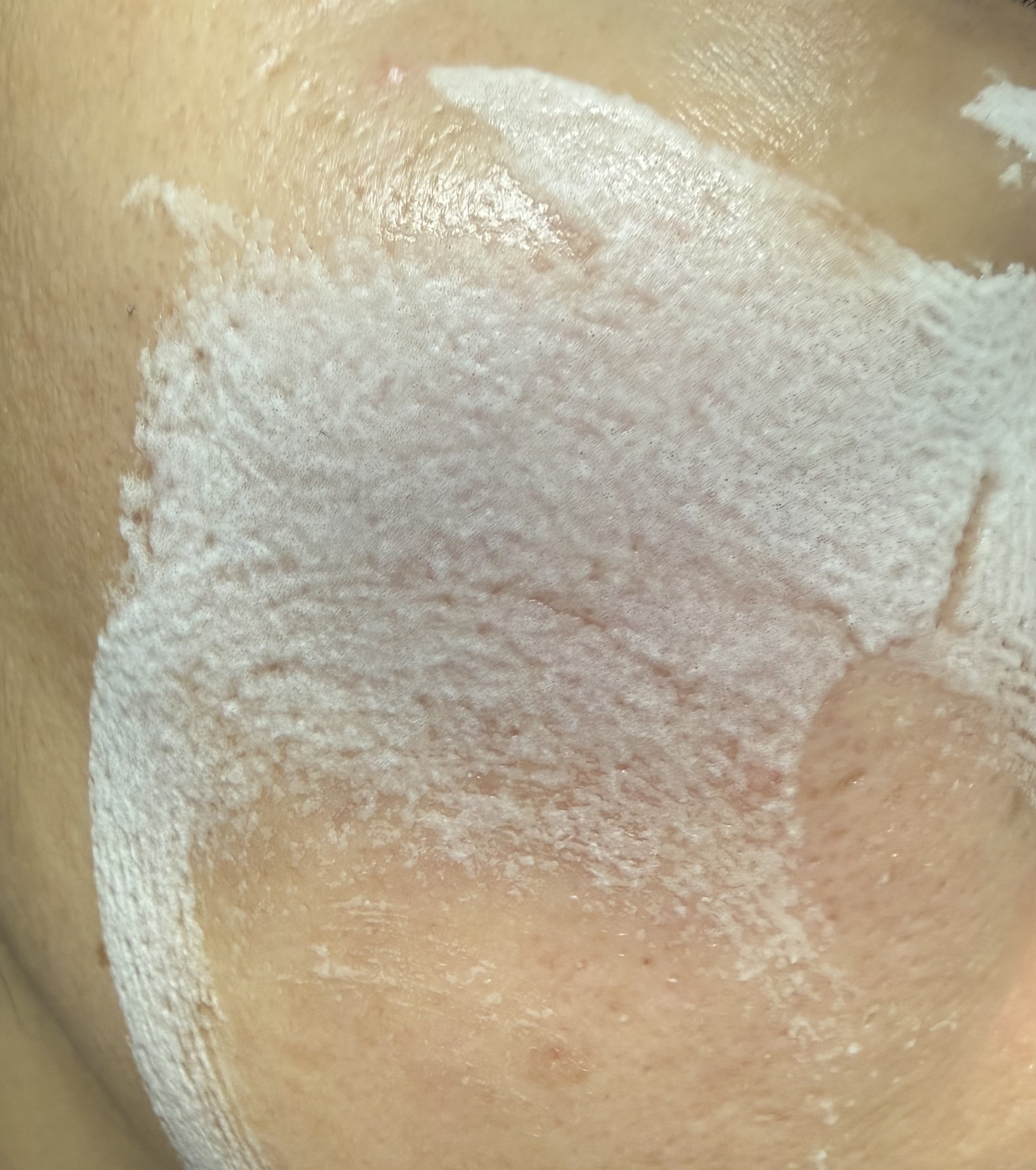 ペプチド ボリューム マスター エッセンス/DR.PEPTI/美容液を使ったクチコミ（3枚目）