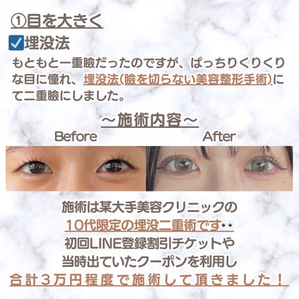 お鼻リフォーマー ハナハナ/グッズマン/その他を使ったクチコミ(3枚目)