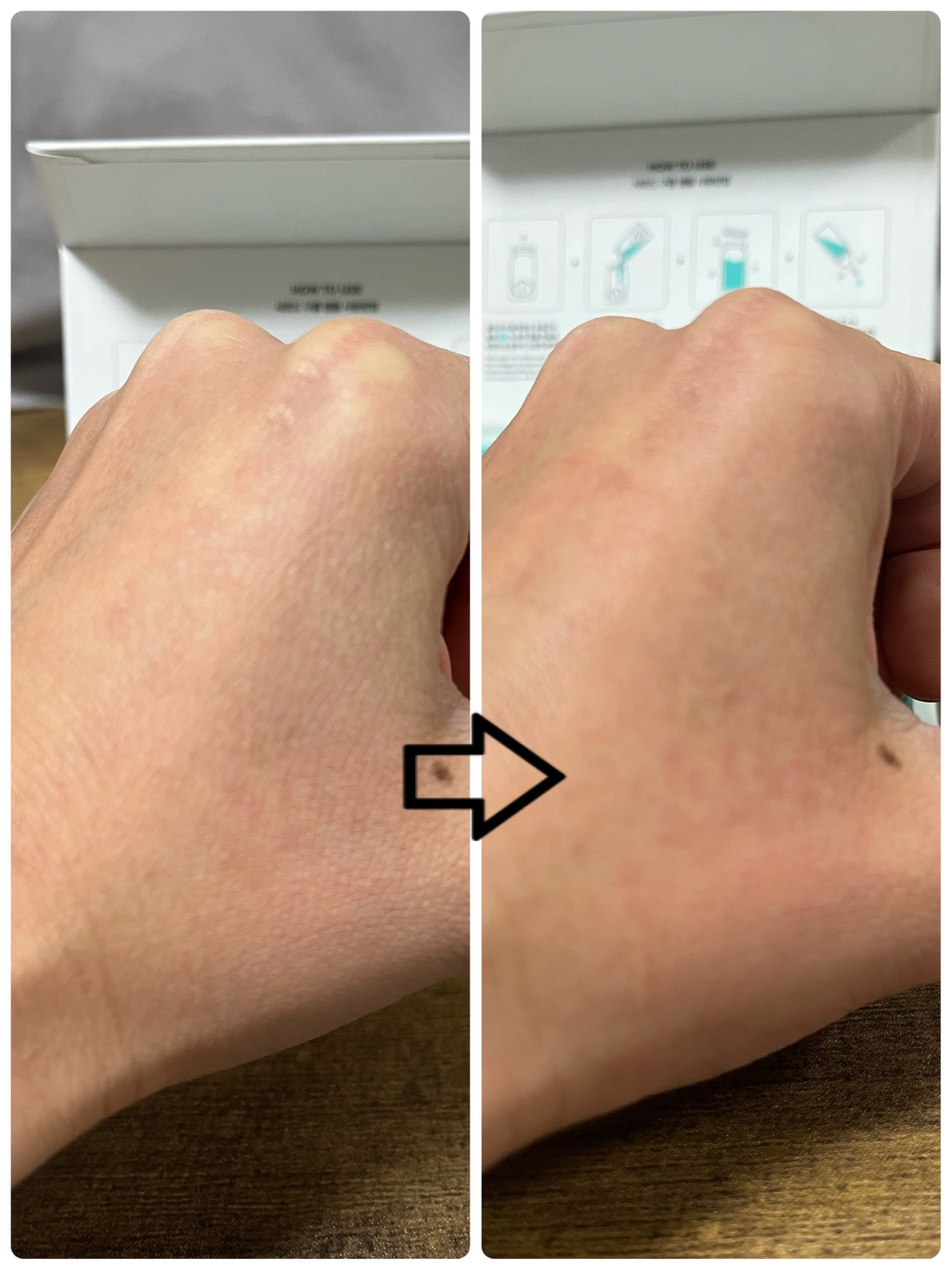 クラウドアンプル 1week キット/CHARDE/美容液を使ったクチコミ(4枚目)