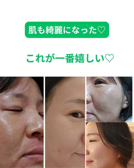 重度のアトピーを克服した40代美容家 on LIPS 「40代になってから「あれ?なんか全体的に元気がない…?」って感..」(8枚目)