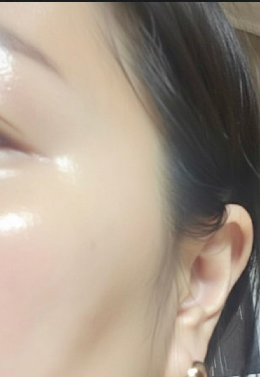 メラピールクリームマスク/CHARDE/ピーリングを使ったクチコミ(3枚目)