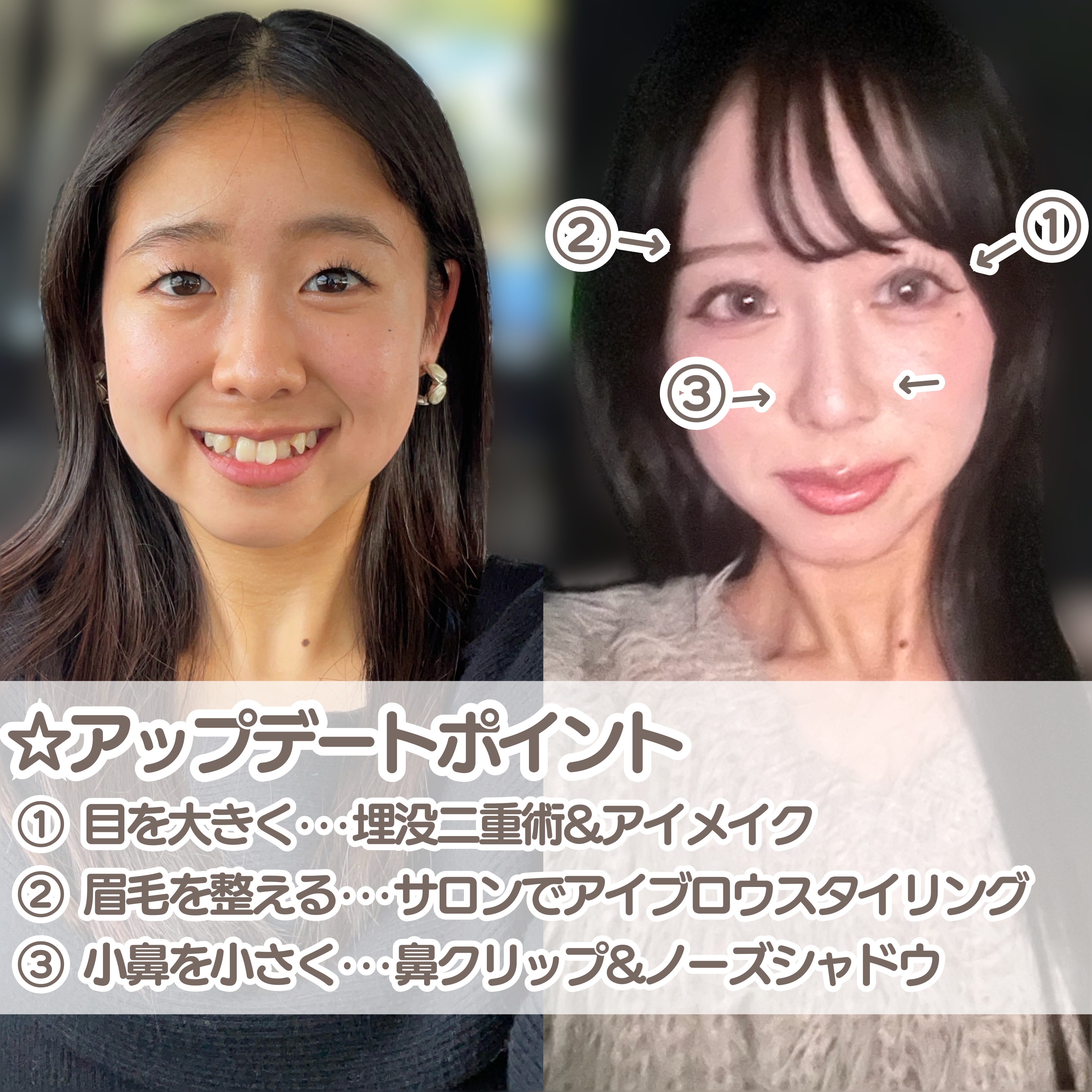 お鼻リフォーマー ハナハナ/グッズマン/その他を使ったクチコミ（2枚目）