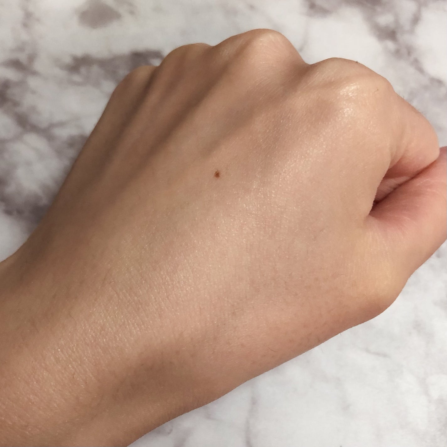 アゼライン酸CICA37セラム/オーズナリー/美容液を使ったクチコミ(6枚目)