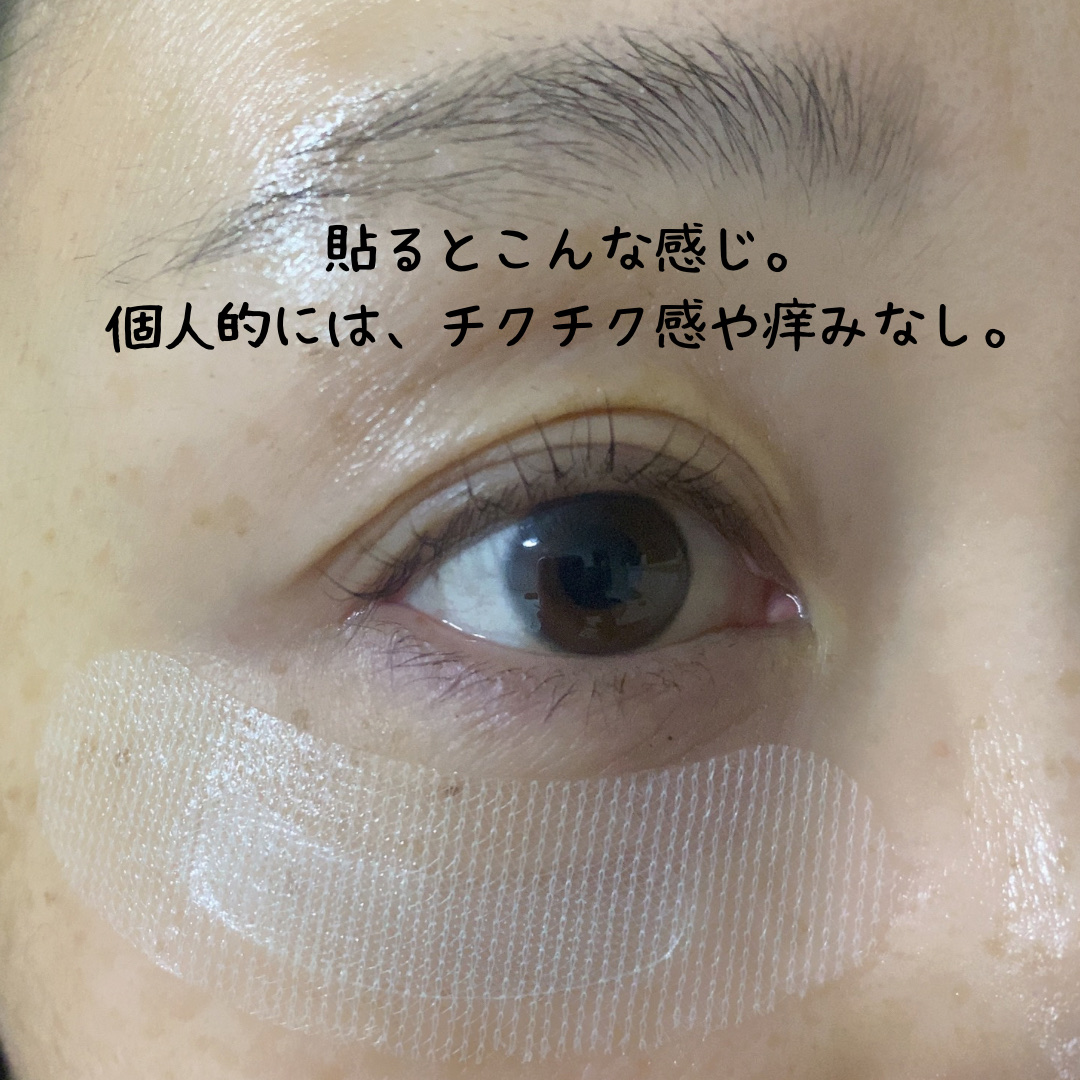 クリアターン ヒアロチューン マイクロパッチ 1500/クリアターン/シートマスク・パックを使ったクチコミ（3枚目）