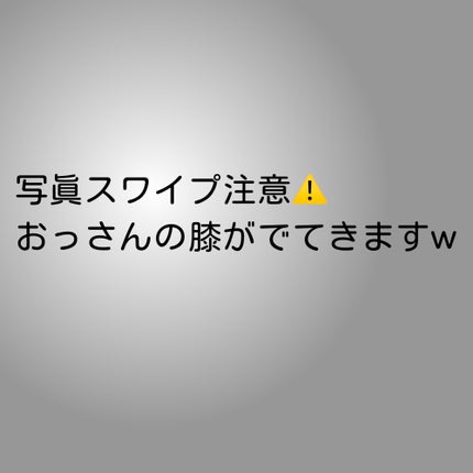 U20クリーム(医薬品)/メンターム/その他を使ったクチコミ(2枚目)