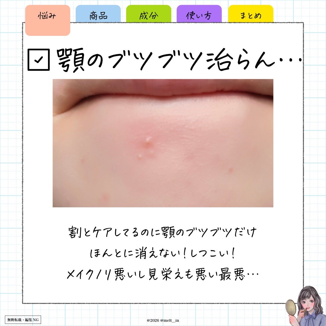 エファクラ ピールケア セラム/ラ ロッシュ ポゼ/美容液を使ったクチコミ(2枚目)