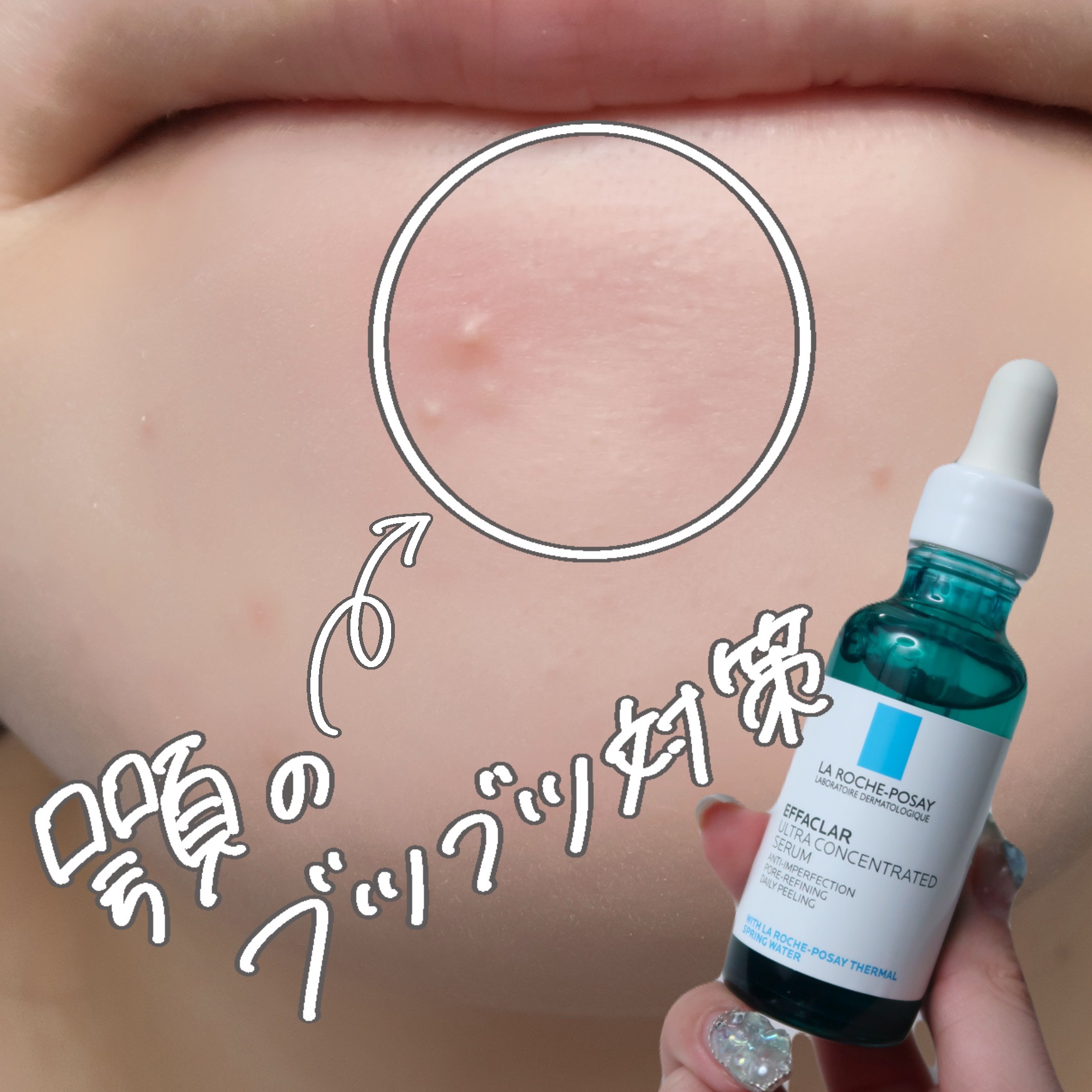 今日は、顎のざらざら対策におすすめの商品レビューしました♡

—————————————

ラロッシュポゼ
エファクラピールケアセラム

5,280円

⁡ —————————————

顎のざらざら何しても全然良くならないんだけど！？
っ