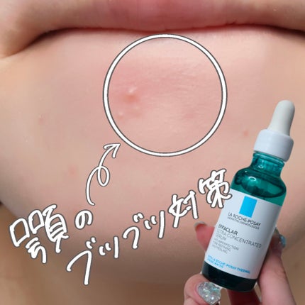 エファクラ ピールケア セラム/ラ ロッシュ ポゼ/美容液を使ったクチコミ(1枚目)