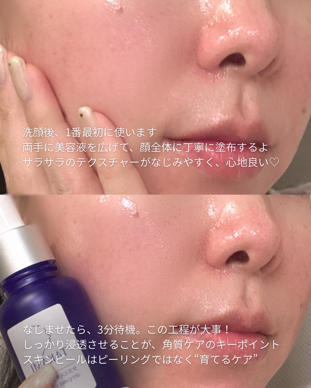 タカミスキンピール/タカミ/ブースター・導入液を使ったクチコミ（3枚目）