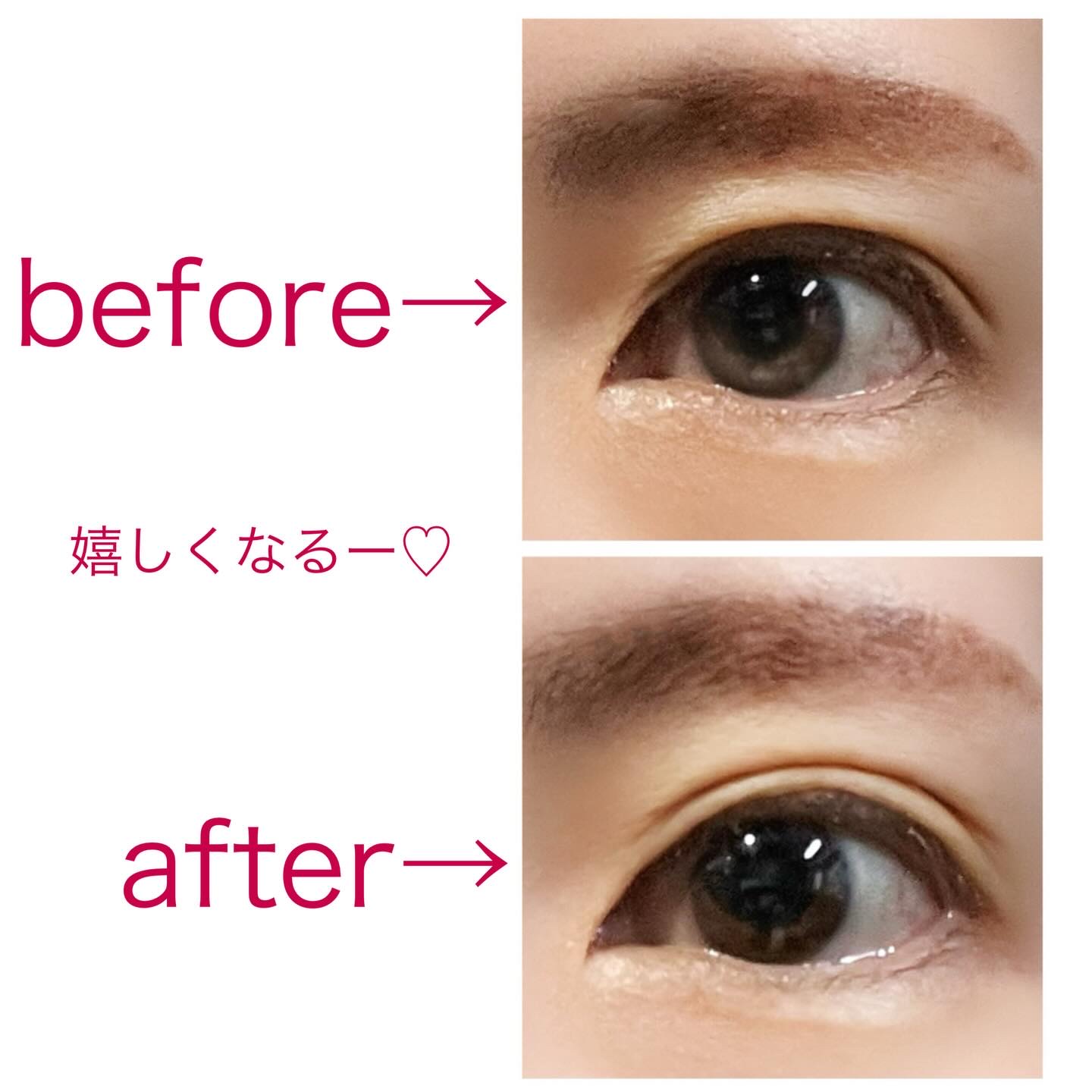 メザイク フリーファイバー120 スタンダードタイプ /メザイク/二重まぶた用アイテムを使ったクチコミ（2枚目）