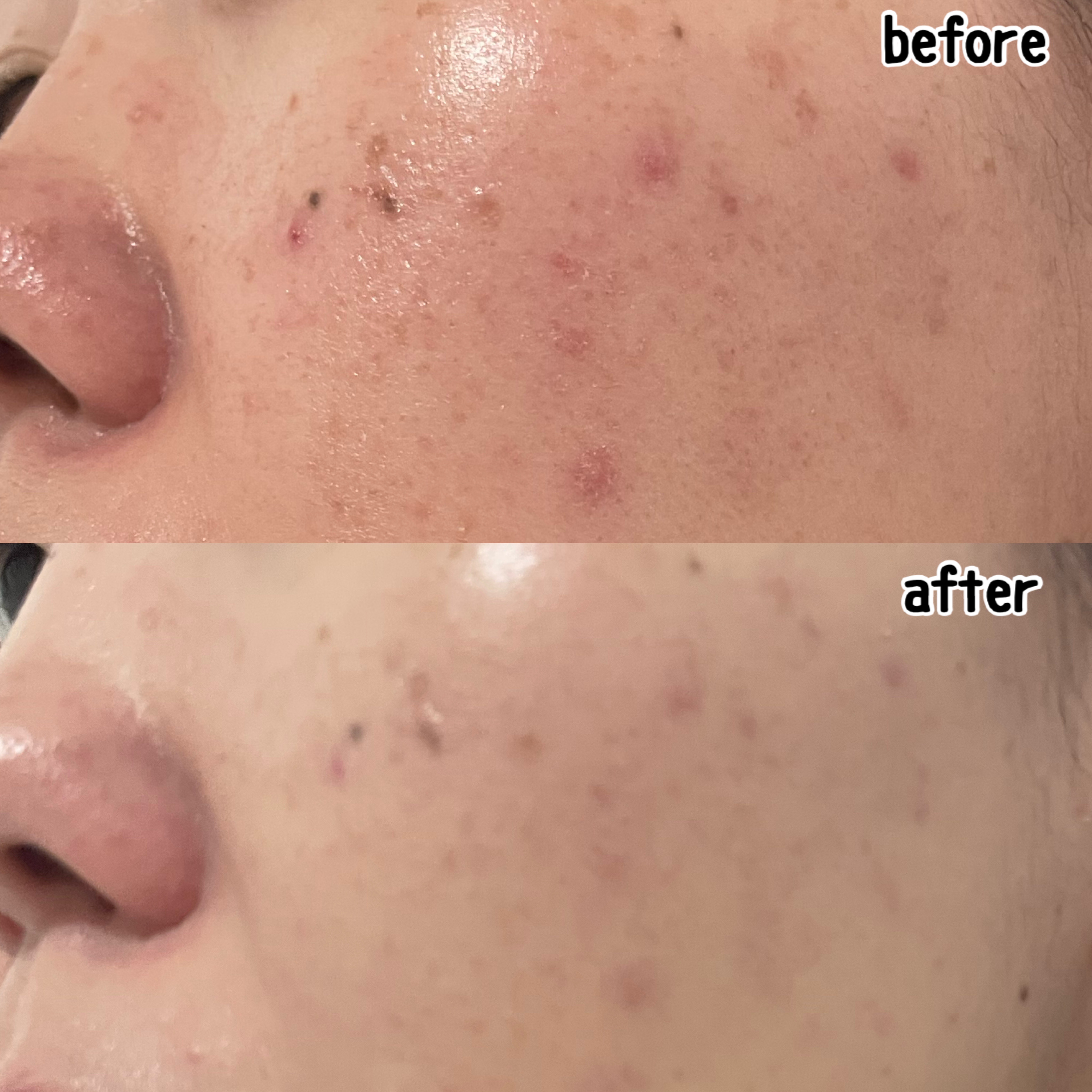 ドラマティックエッセンスクッション グロウ/マキアージュ/クッションファンデーションを使ったクチコミ（2枚目）