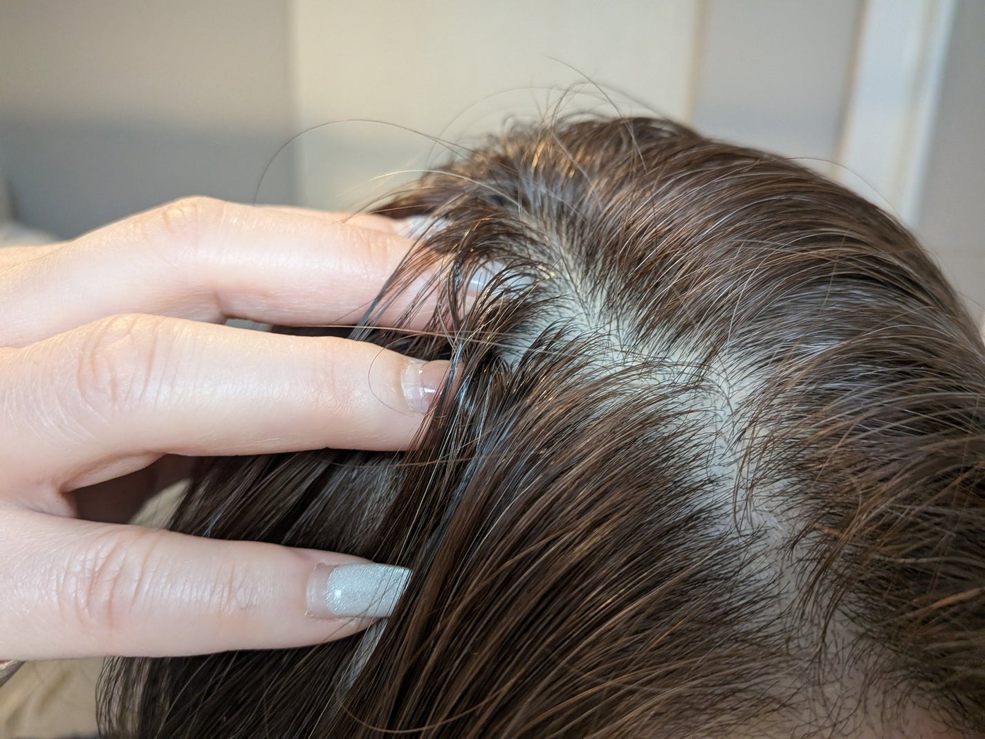 キンギョ姫 on LIPS 「BloomLift頭皮保湿ローション内容量:150mL乾燥やか..」(6枚目)