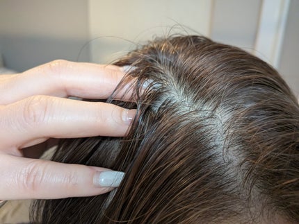 キンギョ姫 on LIPS 「BloomLift頭皮保湿ローション内容量:150mL乾燥やか..」(6枚目)