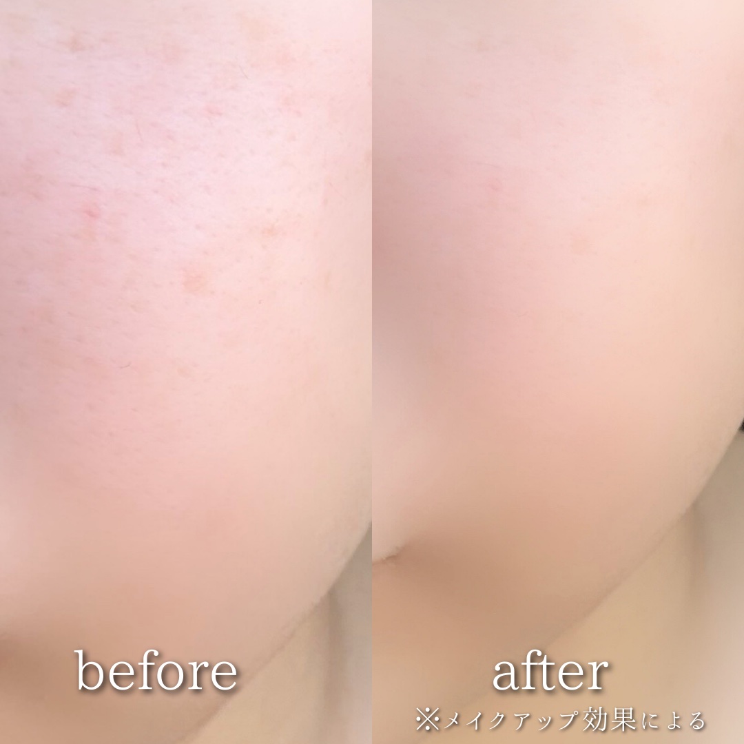 えむ。 投稿ある方ﾌｫﾛﾊﾞ100ﾘﾑﾊﾞ100のクチコミ「30時間*¹崩れない生っぽツヤ肌*²
高機能クッションから イエベ向け新色登場✨

薄づきなの.....」（3枚目）