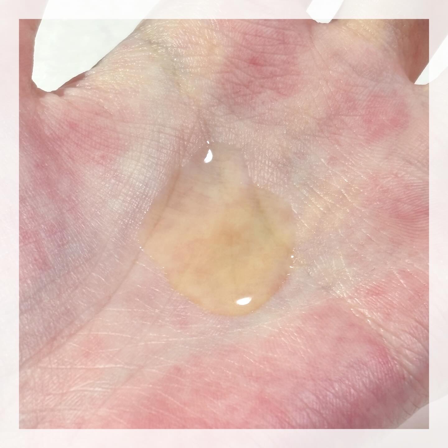 ビタミンC エキスパート25% トーニングアンプル/IOPE/美容液を使ったクチコミ（3枚目）