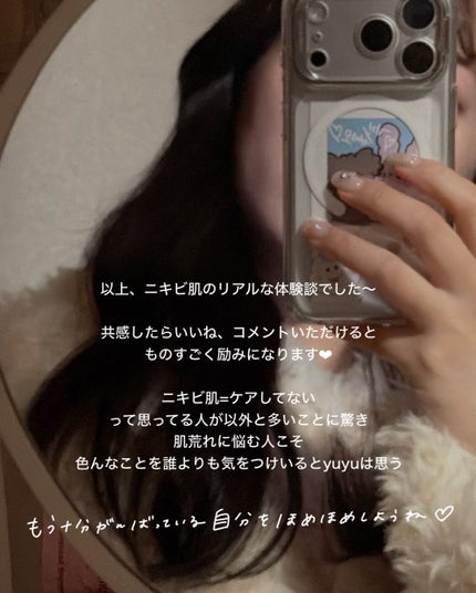 yuyuð¶èèãäœè³ªã®æ£çŽã¬ãã¥ãŒ on LIPS ãé·å¹Žãããèã§æ©ãã§ããŠæ£ã
è²ã
èšãããã倱æãããŠããŸããð¥²..ãïŒ10æç®ïŒ