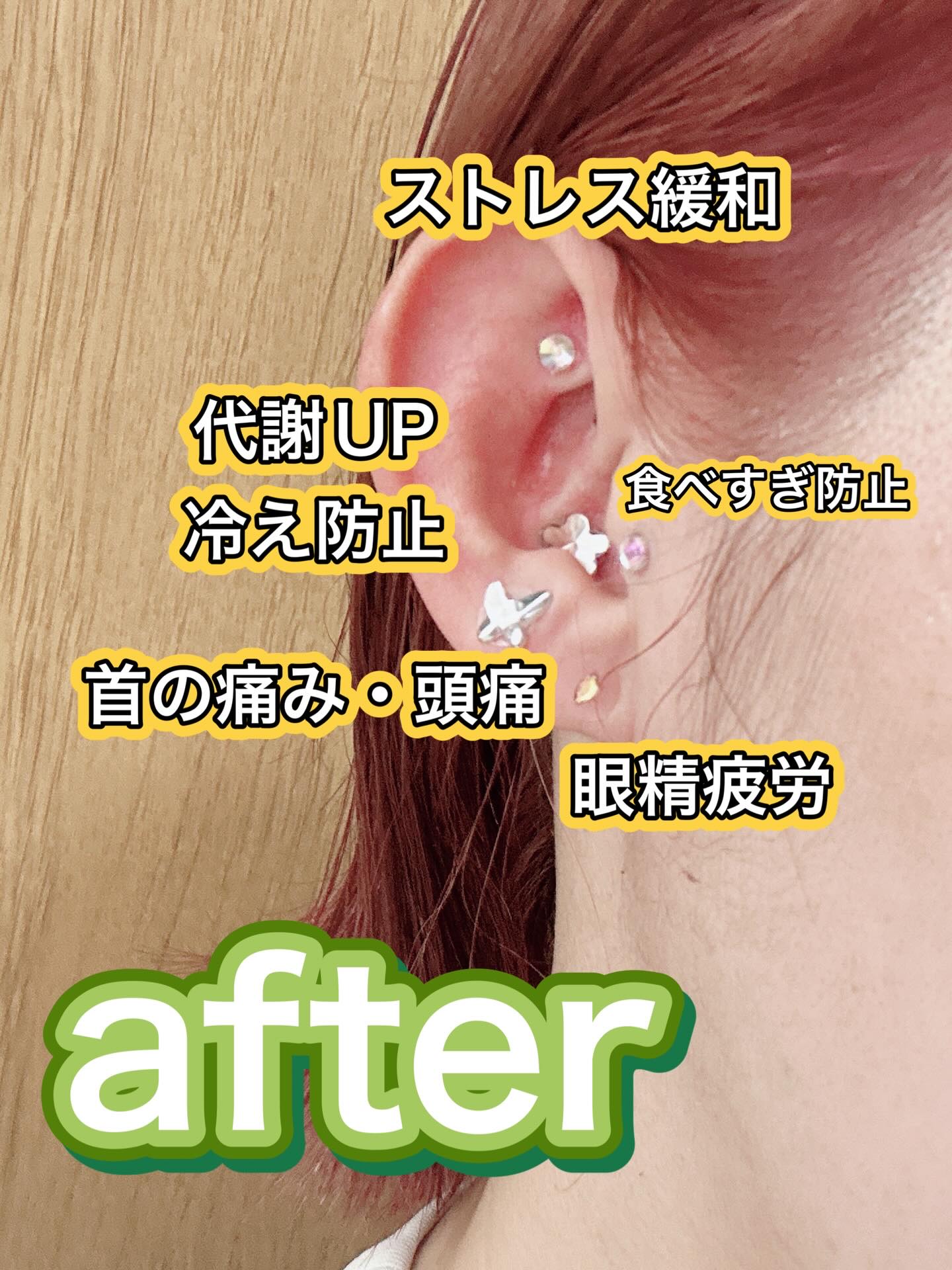 Earbomb/keybo/その他を使ったクチコミ（3枚目）