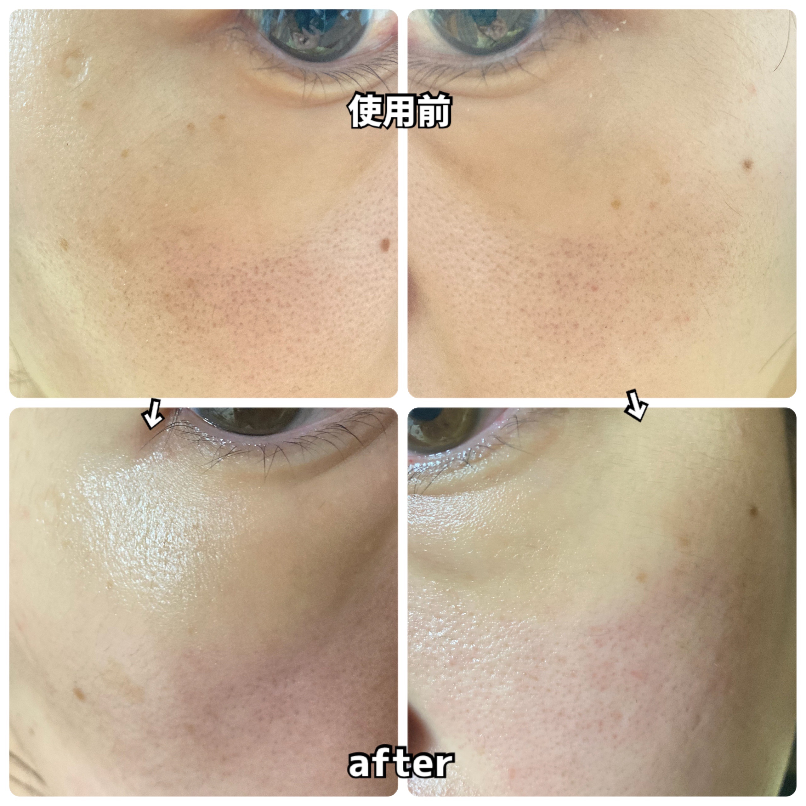 レッドレチノールセラム/Dr.Belmeur/美容液を使ったクチコミ（3枚目）