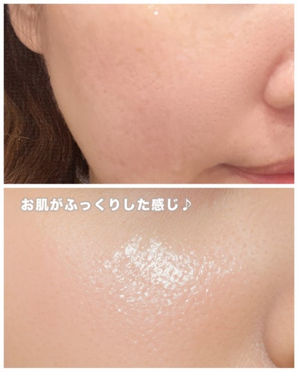 美肌養液 I’m PINCH/I'm PINCH/美容液を使ったクチコミ(5枚目)