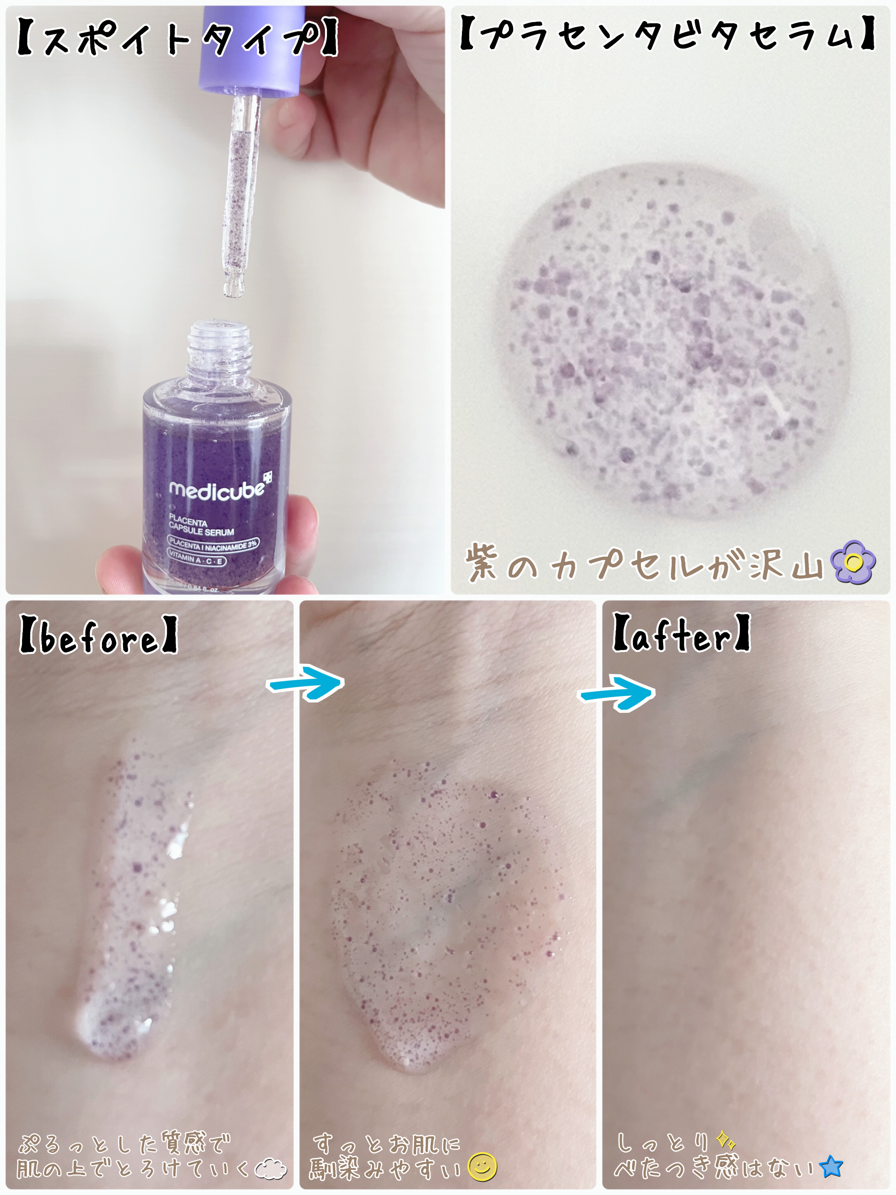 プラセンタビタセラム/MEDICUBE/美容液を使ったクチコミ（2枚目）