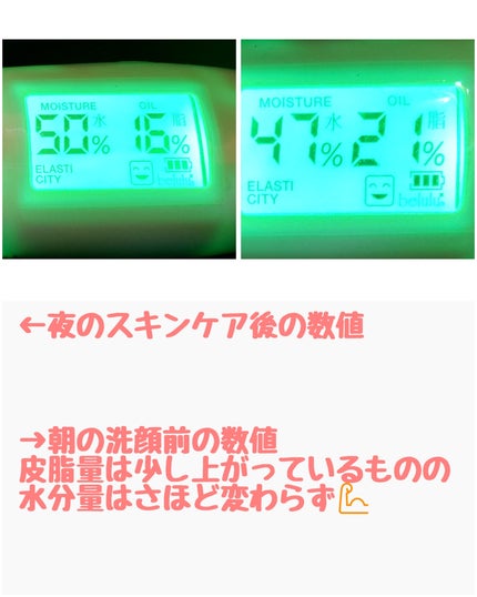 美ルル スキンチェッカー/belulu/美顔器・マッサージを使ったクチコミ(5枚目)