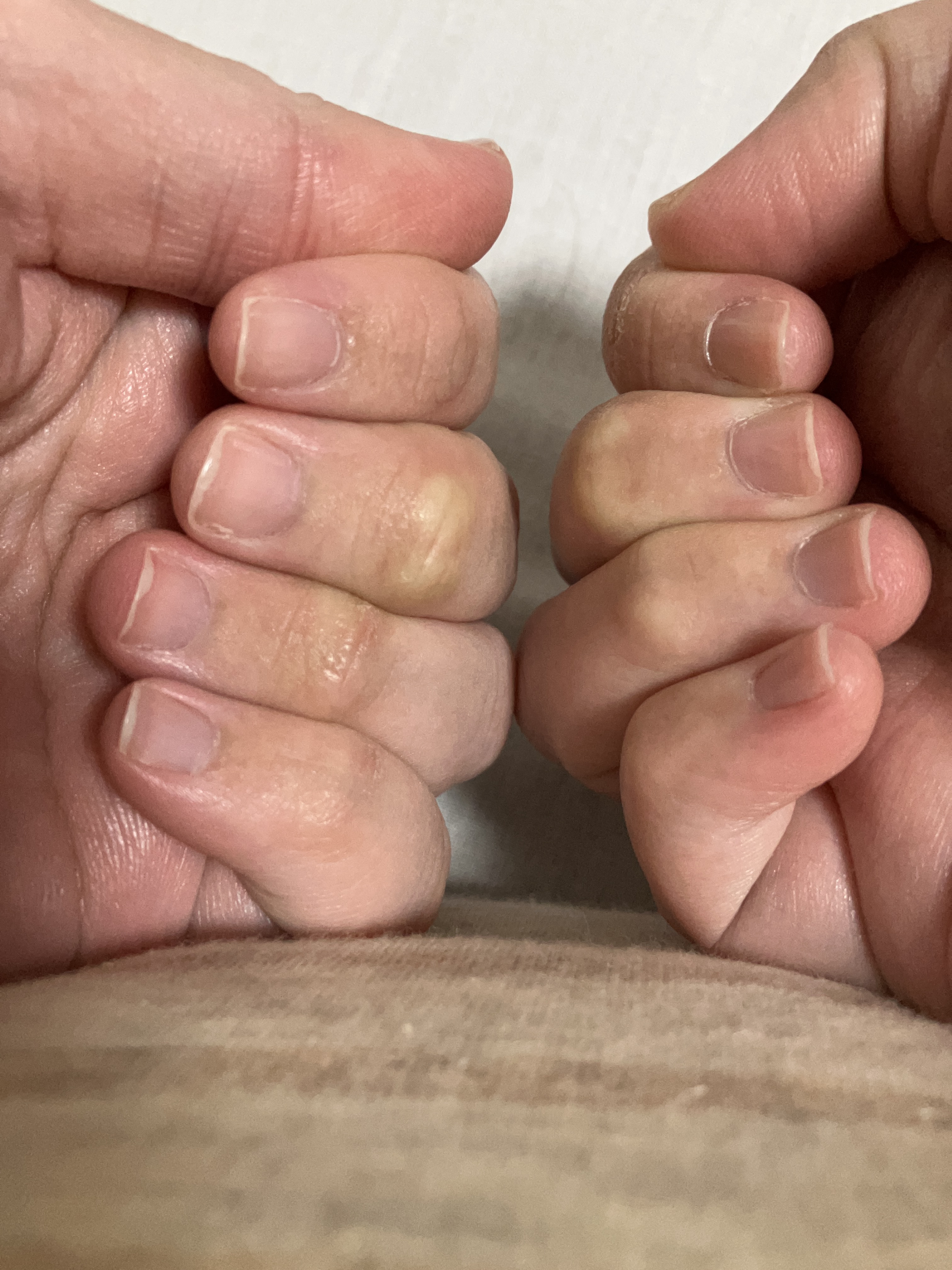 割れ爪補修コート/デュカート/オールインワンネイルを使ったクチコミ（2枚目）