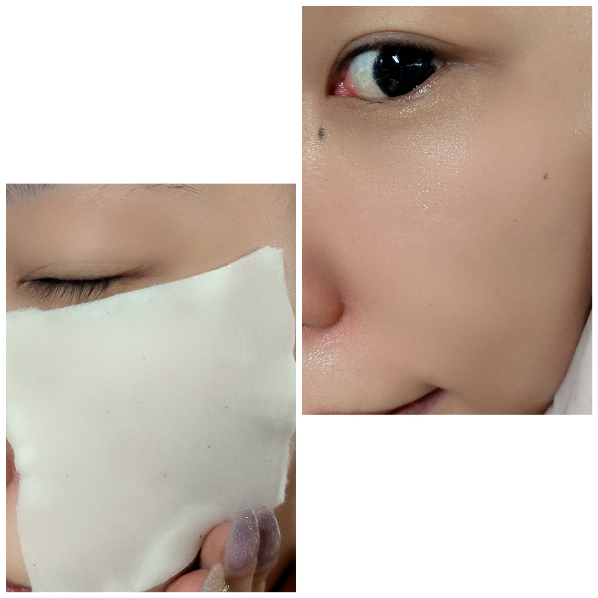 ハトムギエキス化粧水/プラチナレーベル/化粧水を使ったクチコミ（3枚目）